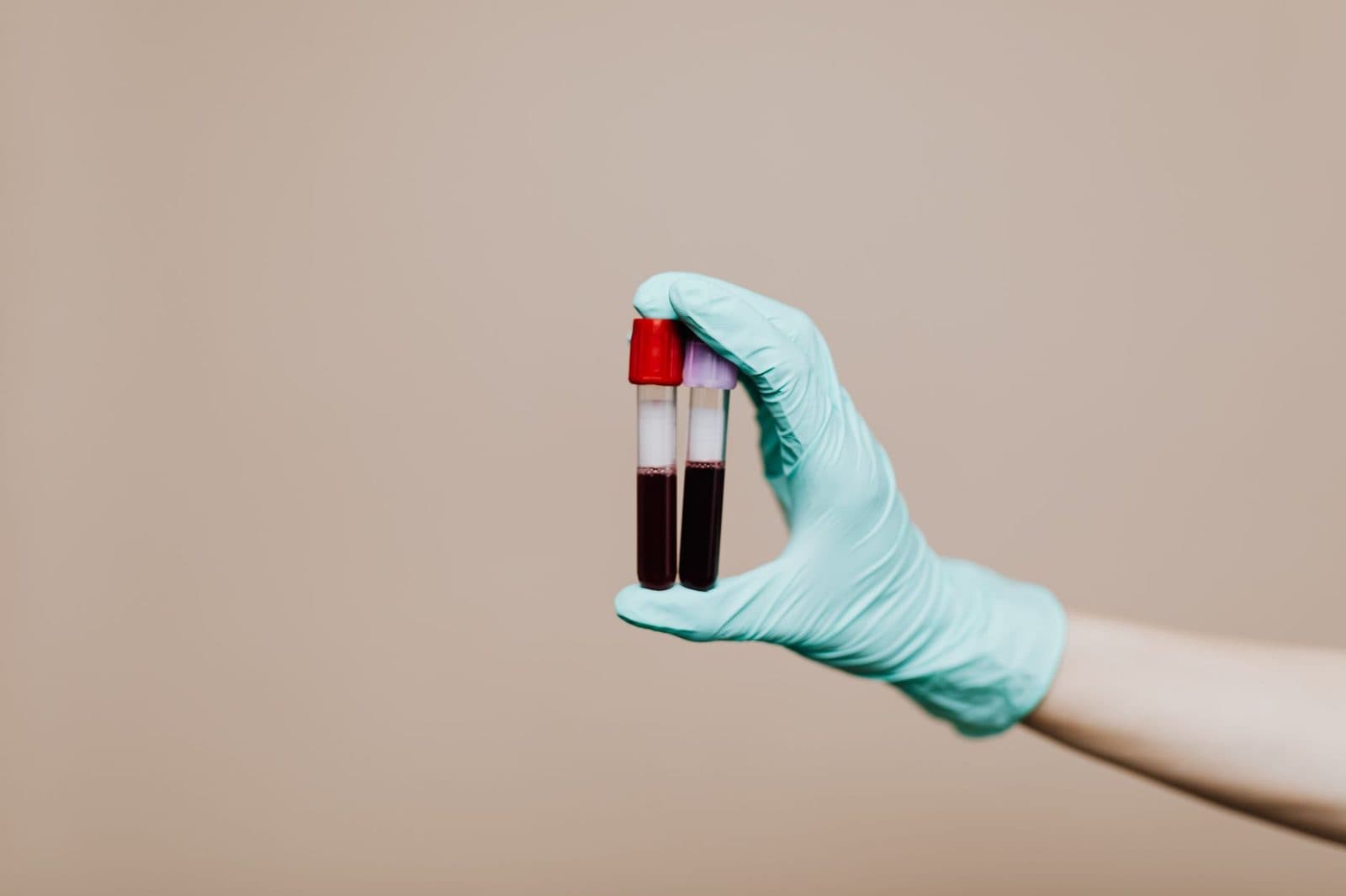 Lab Work Explained: What Your Annual Blood Tests Reveal